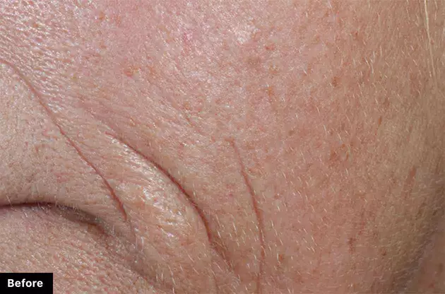 Immagine ravvicinata di una pelle con rughe visibili, evidenziando texture e segni d'invecchiamento.