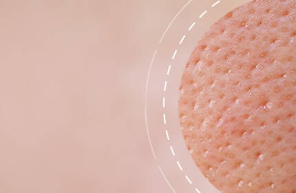 Close-up of textured skin with a soft, neutral background.