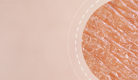 Close-up view of textured skin, featuring a light, warm-toned background with a circular focus on the skin's surface details.