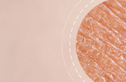 Close-up view of textured skin, featuring a light, warm-toned background with a circular focus on the skin's surface details.