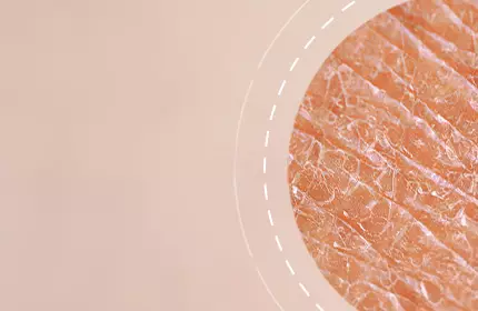 Close-up view of textured skin, featuring a light, warm-toned background with a circular focus on the skin's surface details.