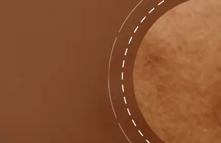 A close-up image of skin texture showing small imperfections against a softly blurred brown background.