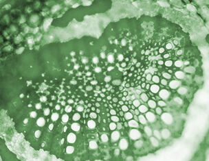 Immagine microscopica di una sezione trasversale di una pianta, mostrando tessuti cellulari verdi e dettagliati.