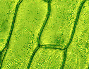 Microscopic view of plant cells, showcasing green chloroplasts and cell walls in a textured pattern.