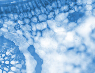 Dettaglio di tessuto vegetale visto al microscopio, con cellule blu che mostrano una struttura intricata e translucida.