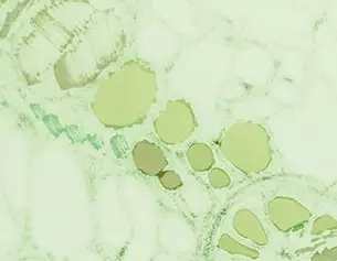 Immagine microscopica di cellule vegetali con aree verdi e sfere, evidenziando la struttura interna.