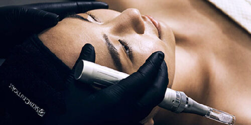 NICHT-ABLATIVER LASER​