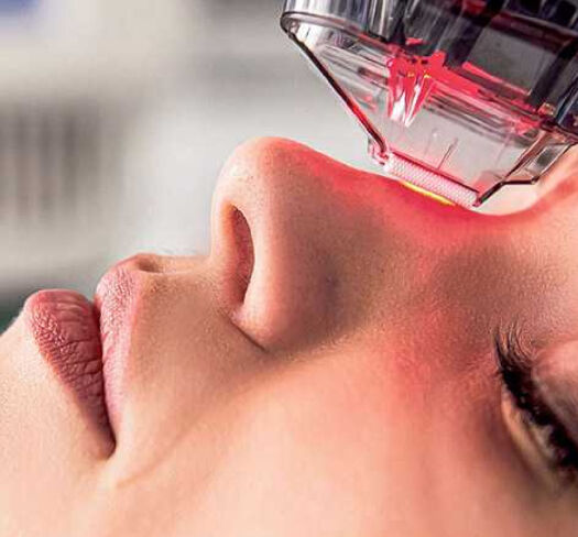 NICHT-ABLATIVER LASER​