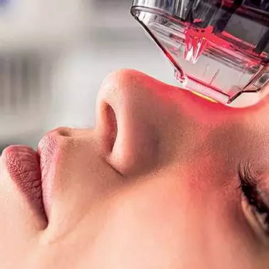 NICHT-ABLATIVER LASER