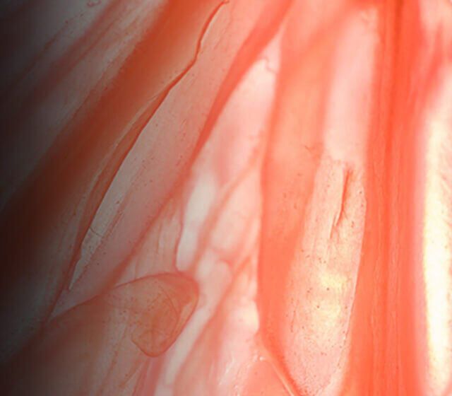 Myrixin Ingredient Image
