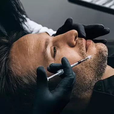 LIP FILLER