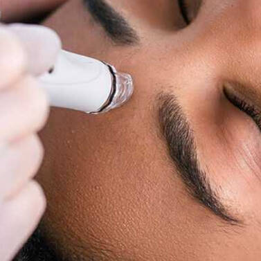 LIP FILLER