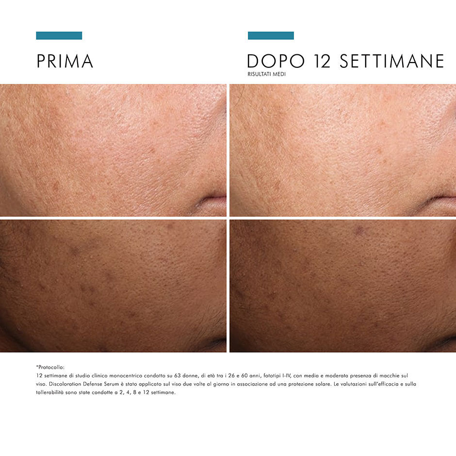 Discoloration Defense Serum