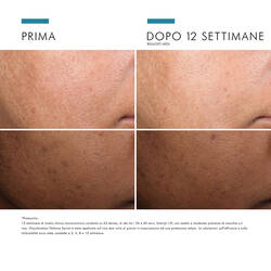 Discoloration Defense Serum