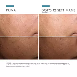 Discoloration Defense Serum
