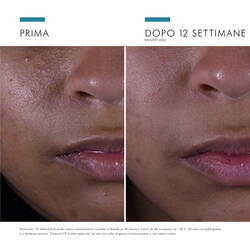 Silymarin CF