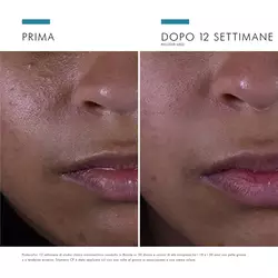 Silymarin CF