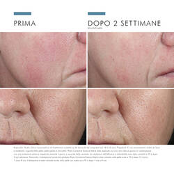 Phyto Corrective Essence Mist