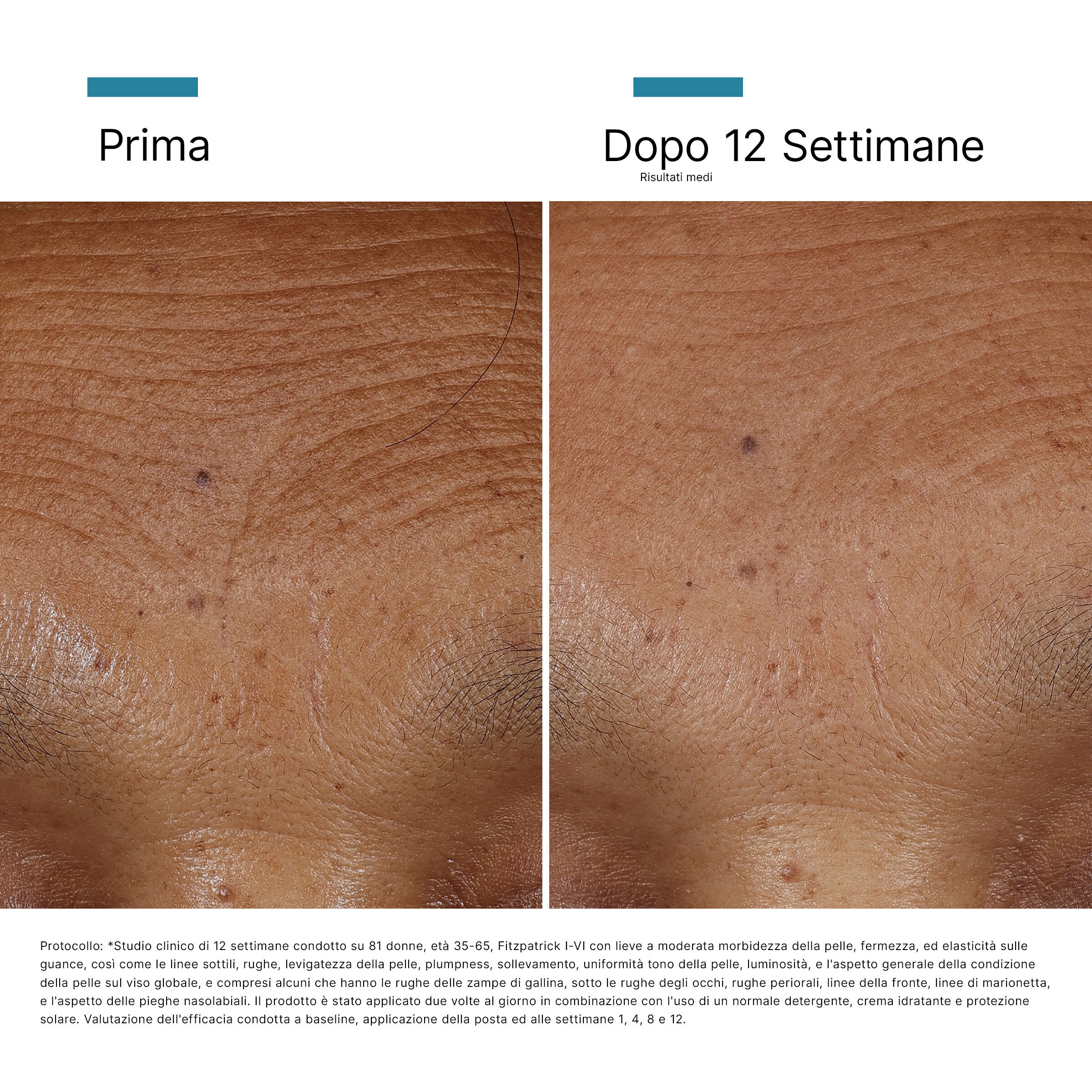 HA Intensifier Multi-Glycan