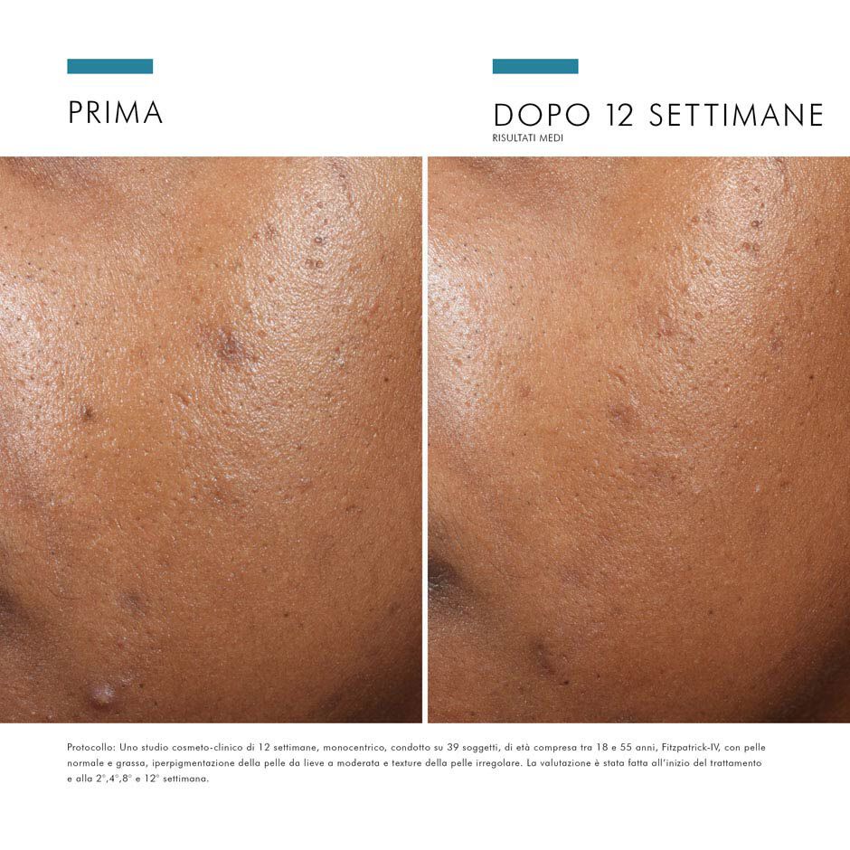 Phyto A+ Brightening Treatment