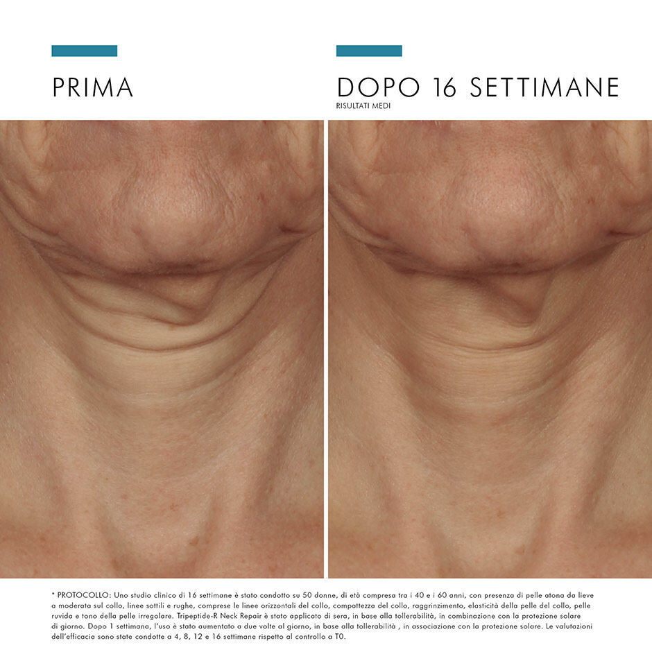 TRIPEPTIDE NECK-REPAIR