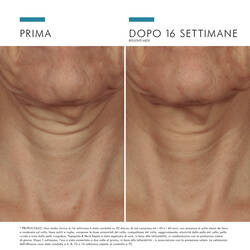 TRIPEPTIDE NECK-REPAIR