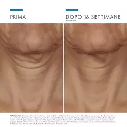 TRIPEPTIDE NECK-REPAIR