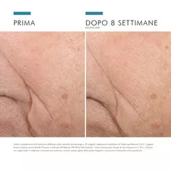 Triple Lipid Restore 2:4:2